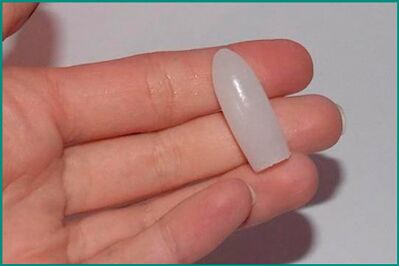 Svecītes cistīta ārstēšanai sievietēm un vīriešiem